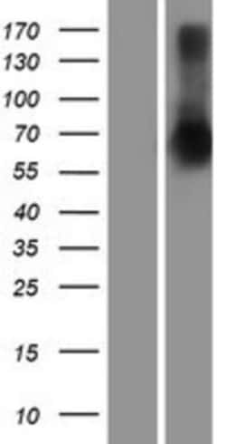 Novus Biologicals™ SETDB2 Overexpression Lysate