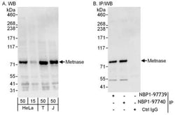 SETMAR Antibody, Novus Biologicals 0.1mg; Unlabeled:Antibodies, Polyclonal