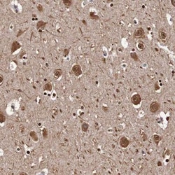 SEZ6/BSRP-C Antibody, Novus Biologicals 0.1mL; Unlabeled:Antibodies, Polyclonal