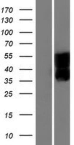 Novus Biologicals&trade;&nbsp;SEZ6L Overexpression Lysate