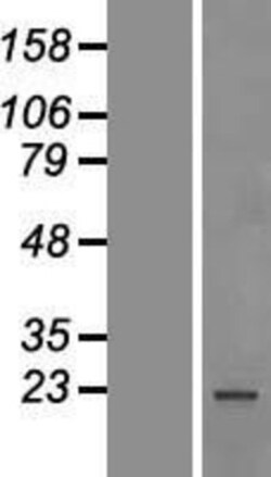Novus Biologicals&trade;&nbsp;SF2 Overexpression Lysate