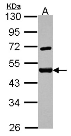 SF3A2 Antibody, Novus Biologicals 0.1mL; Unlabeled:Antibodies, Polyclonal