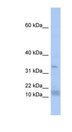 SF3B14 Antibody, Novus Biologicals:Antibodies:Primary Antibodies