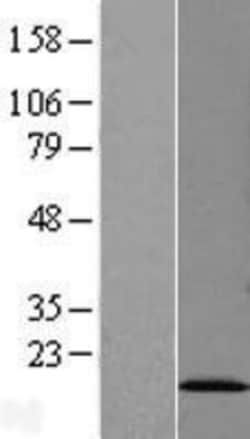 Novus Biologicals&trade;&nbsp;SF3B14 Overexpression Lysate