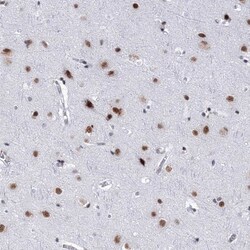 SF3B14 Antibody, Novus Biologicals 0.1mL; Unlabeled:Antibodies, Polyclonal