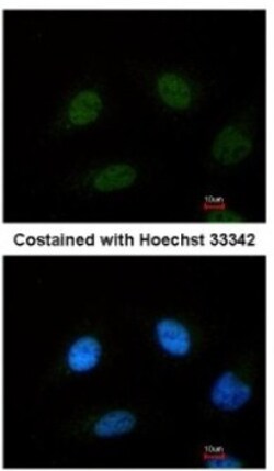 anti-SF3B4, Polyclonal, Novus Biologicals 0.1 mL | Buy Online | Novus Biologicals | Fisher Scientific