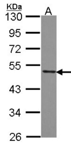anti-SF3B4, Polyclonal, Novus Biologicals 0.1 mL | Buy Online | Novus Biologicals | Fisher Scientific