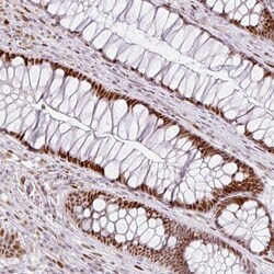 SF3B5 Antibody, Novus Biologicals 0.1mL; Unlabeled:Antibodies, Polyclonal