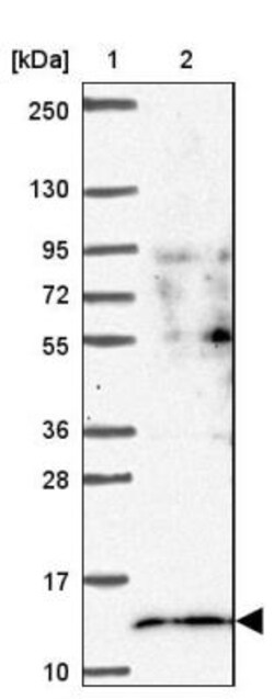 SF3B5 Antibody, Novus Biologicals 0.1mL; Unlabeled:Antibodies, Polyclonal