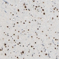 SF4 Antibody, Novus Biologicals 0.1mL; Unlabeled:Antibodies, Polyclonal