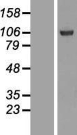 Novus Biologicals&trade;&nbsp;SFMBT1 Overexpression Lysate