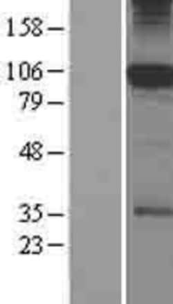 Novus Biologicals™ SFMBT1 Overexpression Lysate