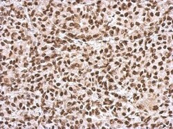SFPQ Antibody, Novus Biologicals 0.1mL; Unlabeled:Antibodies, Polyclonal