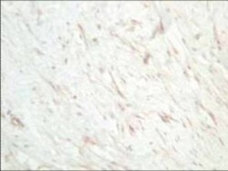 sFRP-1 Antibody, Novus Biologicals 0.1mg; Unlabeled:Antibodies, Polyclonal