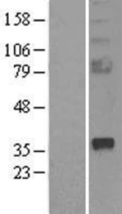 Novus Biologicals&trade;&nbsp;sFRP-2 Overexpression Lysate
