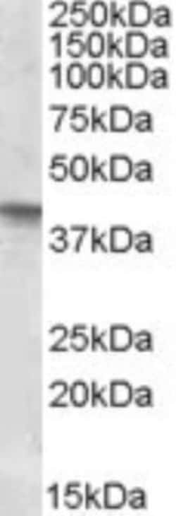 sFRP-4 Antibody, Novus Biologicals 0.1mg; Unlabeled:Antibodies, Polyclonal