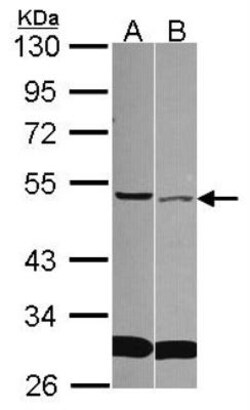 sFRP-4 Antibody, Novus Biologicals 0.1mL; Unlabeled:Antibodies, Polyclonal