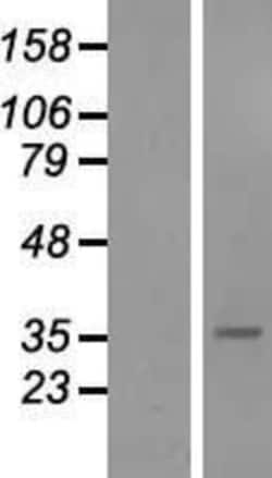 Novus Biologicals&trade;&nbsp;sFRP-5 Overexpression Lysate