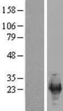 Novus Biologicals™ SFRS12IP1 Overexpression Lysate
