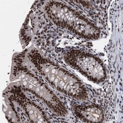 SFRS15 Antibody, Novus Biologicals 0.1mL; Unlabeled:Antibodies, Polyclonal