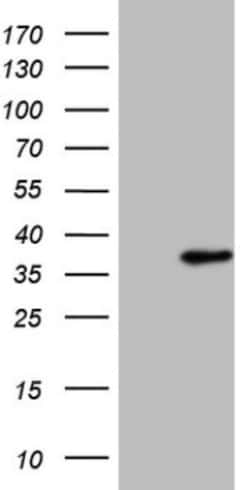 SFRS9 Antibody (OTI5G7), Novus Biologicals 0.1 mL | Buy Online | Novus Biologicals | Fisher Scientific