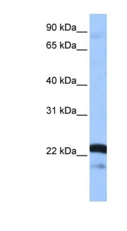 SFRS9 Antibody, Novus Biologicals 0.05mg; Unlabeled:Antibodies, Polyclonal