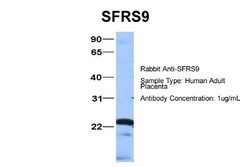 SFRS9 Antibody, Novus Biologicals 0.05mg; Unlabeled:Antibodies, Polyclonal