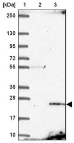 SFT2B Antibody, Novus Biologicals:Antibodies:Primary Antibodies