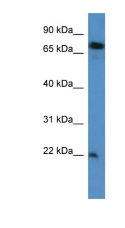 SFT2D3 Antibody, Novus Biologicals 100μL; Unlabeled:Antibodies, Polyclonal