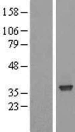 Novus Biologicals&trade;&nbsp;SFXN3 Overexpression Lysate