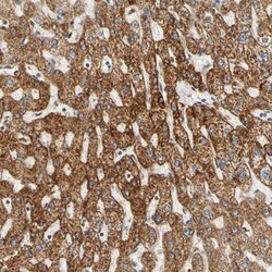 SFXN3 Antibody, Novus Biologicals 25 &mu;L | Buy Online | Novus Biologicals | Fisher Scientific