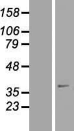 Novus Biologicals&trade;&nbsp;SFXN4 Overexpression Lysate