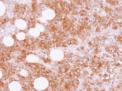 epsilon-Sarcoglycan Antibody, Novus Biologicals 0.1mL; Unlabeled:Antibodies,