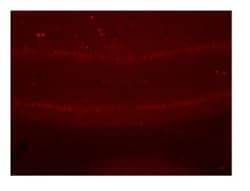 epsilon-Sarcoglycan Antibody, Novus Biologicals:Antibodies:Primary Antibodies