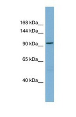 SGEF Antibody, Novus Biologicals 0.05mg; Unlabeled:Antibodies, Polyclonal