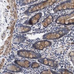 SGEF Antibody, Novus Biologicals:Antibodies:Primary Antibodies