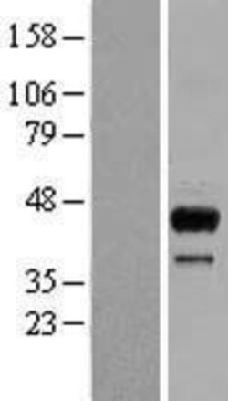 Novus Biologicals&trade;&nbsp;SGK2 Overexpression Lysate