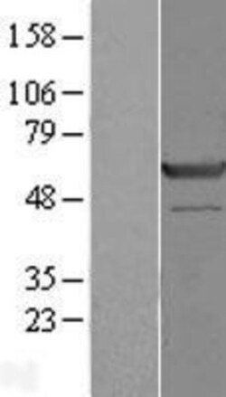 Novus Biologicals&trade;&nbsp;SGK3 Overexpression Lysate