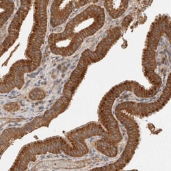 SGK3 Antibody, Novus Biologicals 0.1mL; Unlabeled:Antibodies, Polyclonal