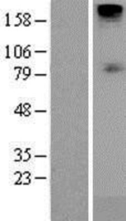 Novus Biologicals&trade;&nbsp;SGLT1/SLC5A1 Overexpression Lysate