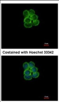 SGLT1/SLC5A1 Antibody, Novus Biologicals 0.1mL; Unlabeled:Antibodies, Polyclonal