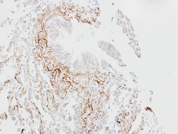 SGLT1/SLC5A1 Antibody, Novus Biologicals 0.1mL; Unlabeled:Antibodies, Polyclonal