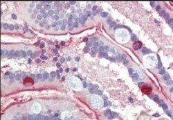 SGLT1/SLC5A1 Antibody, Novus Biologicals 0.1mg; Unlabeled:Antibodies, Polyclonal