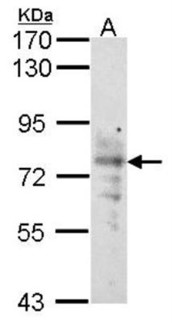 SGLT1/SLC5A1 Antibody, Novus Biologicals 0.1mL; Unlabeled:Antibodies, Polyclonal