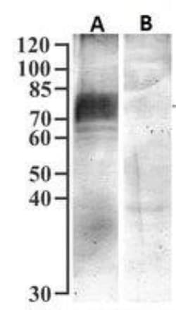 SGLT1/SLC5A1 Antibody, Novus Biologicals 0.1mg; Unlabeled:Antibodies, Polyclonal