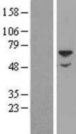 Novus Biologicals&trade;&nbsp;Sulfamidase/SGSH Overexpression Lysate
