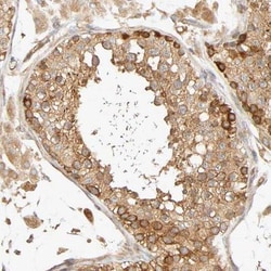 SGSM1 Antibody, Novus Biologicals:Antibodies:Primary Antibodies