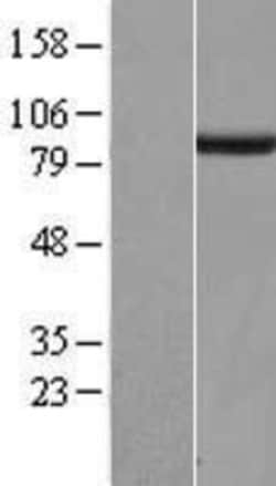Novus Biologicals&trade;&nbsp;SGSM3 Overexpression Lysate