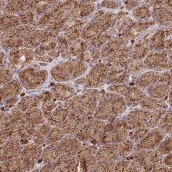 SGSM3 Antibody, Novus Biologicals 25ul | Buy Online | Novus Biologicals | Fisher Scientific