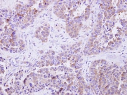 SGTA Antibody, Novus Biologicals 0.1mg; Unlabeled:Antibodies, Polyclonal